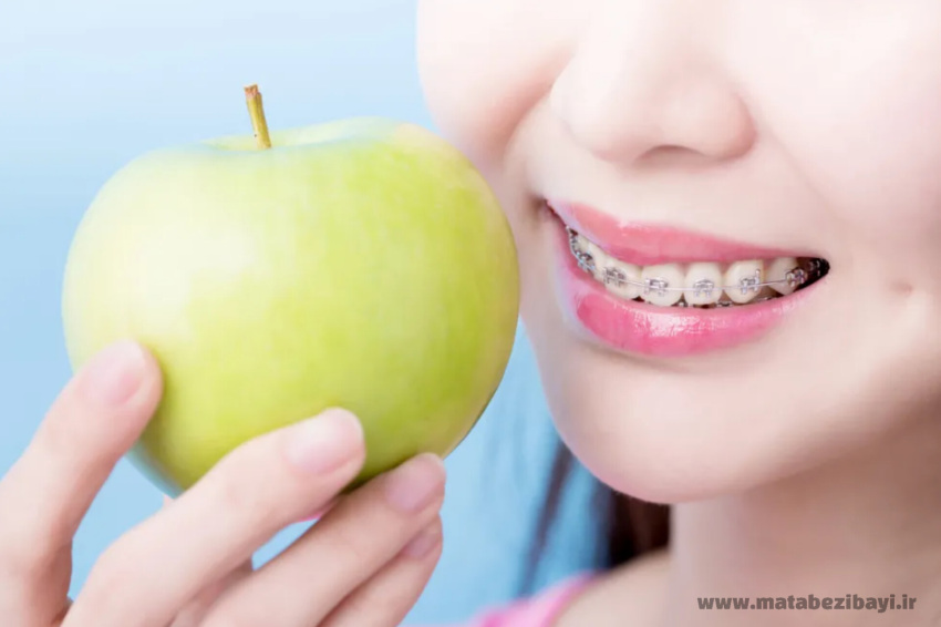 بعد از ارتودنسی چی بخوریم