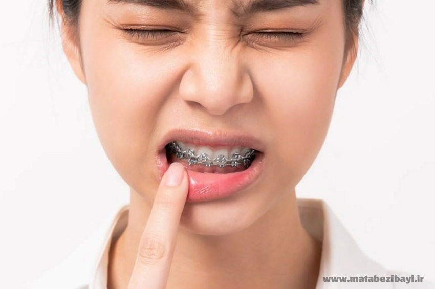 درد دندان بعد از ارتودنسی