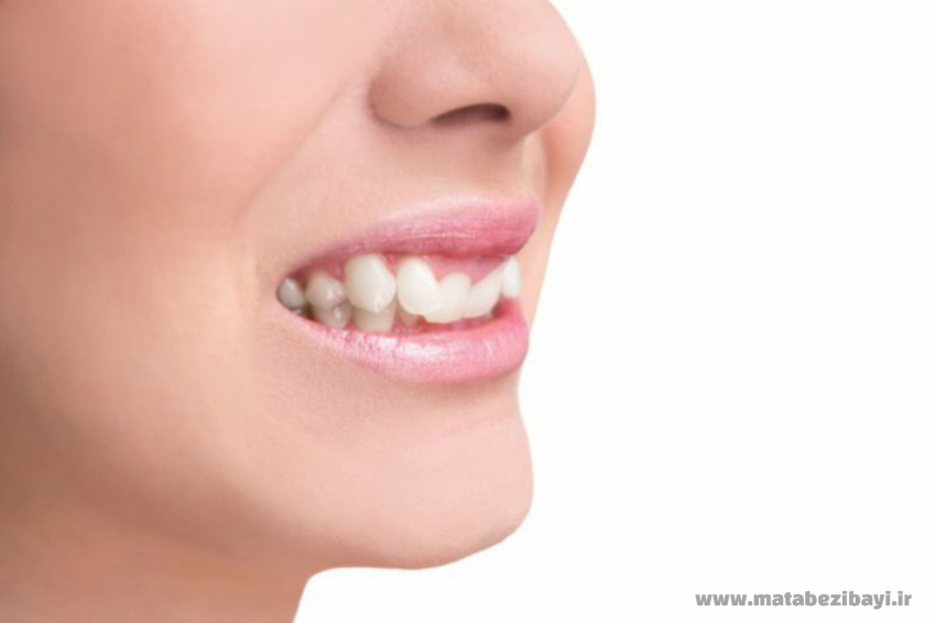 برگشت ارتودنسی