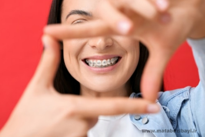 مدت زمان ارتودنسی