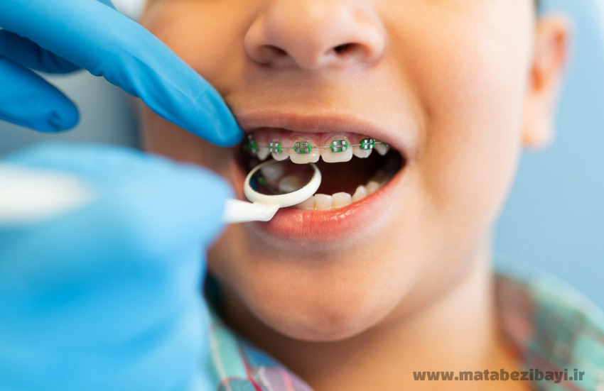 ارتودنسی‌ کودکان