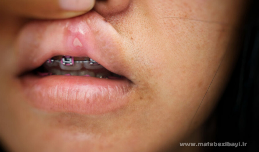 مشکلات بعد از ارتودنسی‌