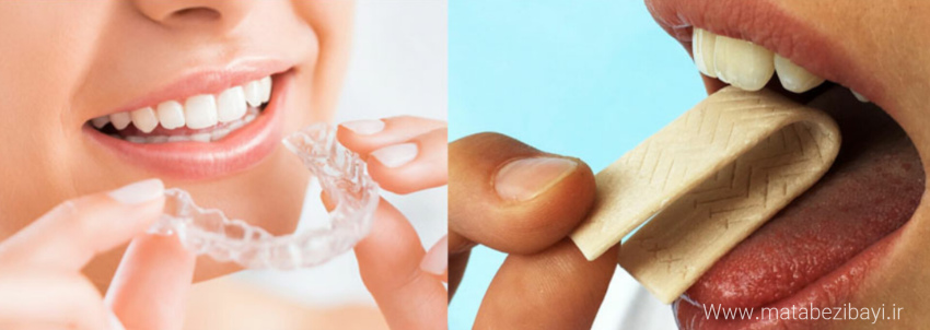 جویدن آدامس در ارتودنسی