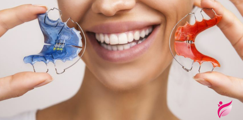 برداشتن براکت ارتودنسی