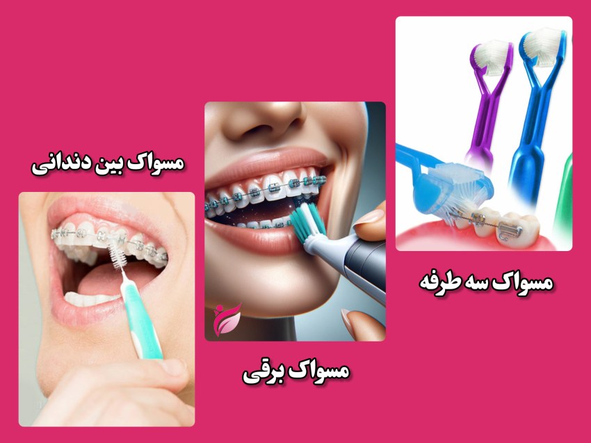 مسواک مخصوص ارتودنسی