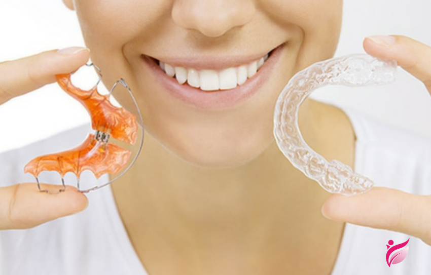 ارتودنسی متحرک