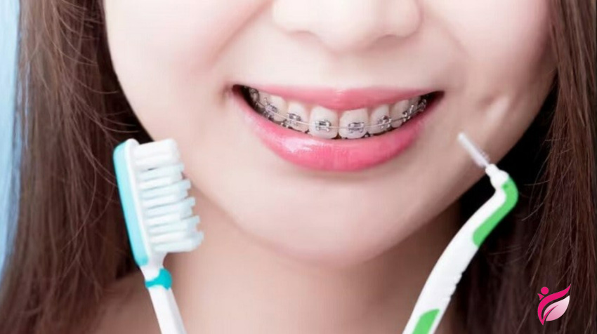 کاهش طول درمان ارتودنسی