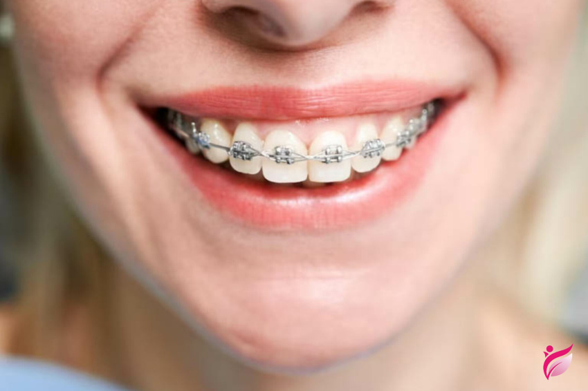 ارتودنسی چیست؟