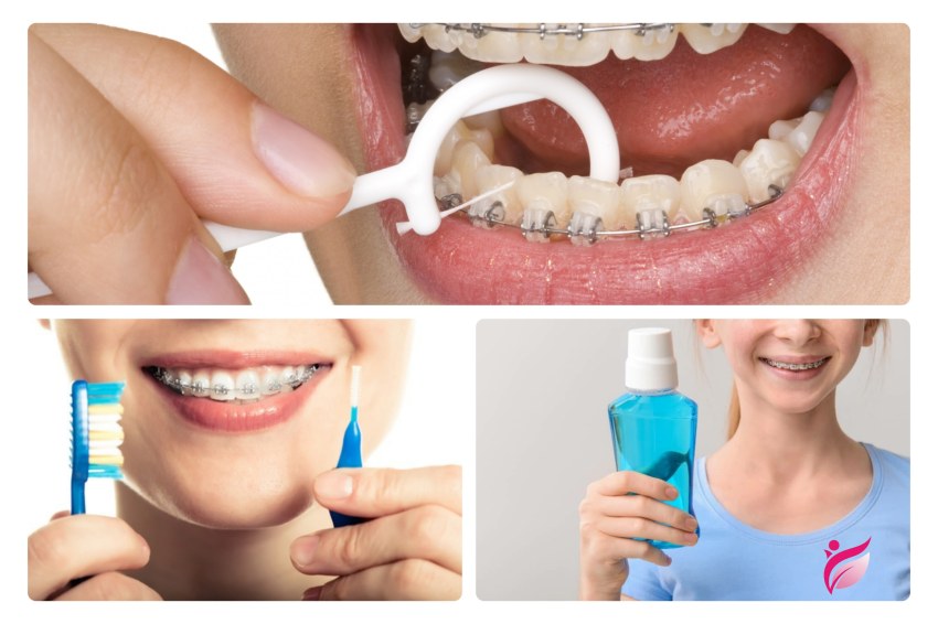 ارتودنسی چیست؟