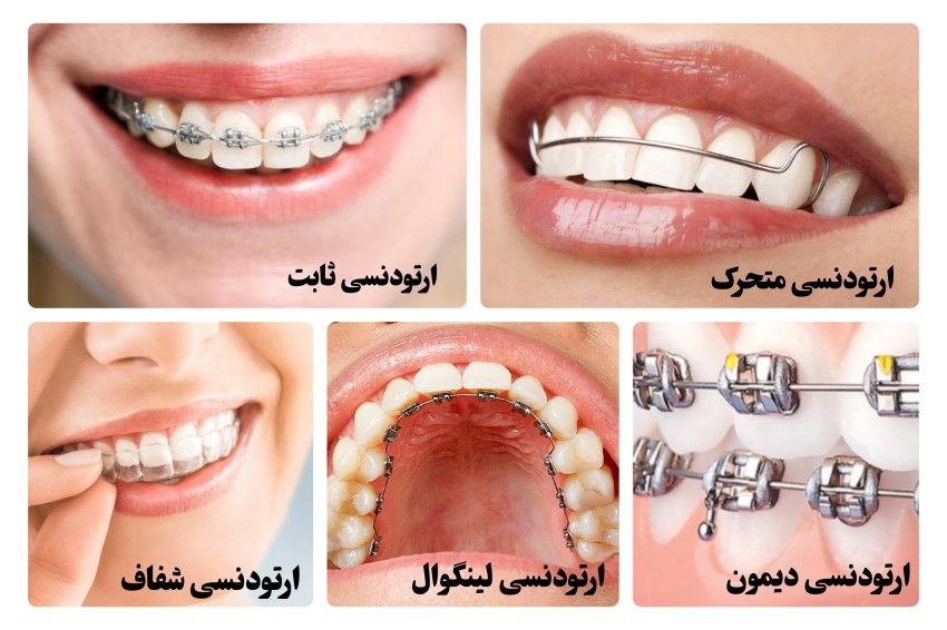 ارتودنسی چیست؟