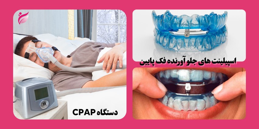 درمان آپنه خواب با ارتودنسی
