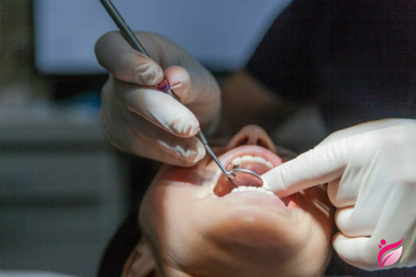 دندان عقل در ارتودنسی